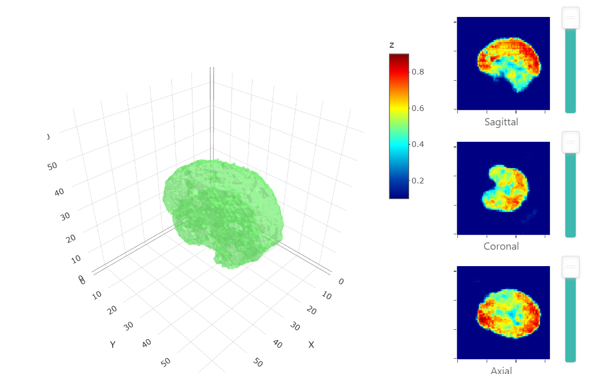 SOCR Synthetic Brain Generator